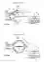Fig. 04 - BALLOON CATHETER ABLATION SYSTEM