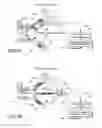 Fig. 05 - BALLOON CATHETER ABLATION SYSTEM