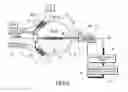 Fig. 06 - BALLOON CATHETER ABLATION SYSTEM