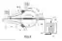 Fig. 08 - BALLOON CATHETER ABLATION SYSTEM