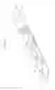 Fig. 13 - Catheter with liquid-cooled control handle