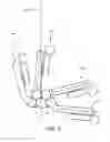Fig. 09 - Movable surgical mounting platform controlled by manual motion of robotic arms