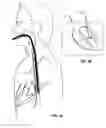 Fig. 04 - ENDO-NAVIGATION SYSTEMS AND METHODS FOR SURGICAL PROCEDURES AND CPR
