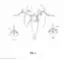 Fig. 05 - ENDO-NAVIGATION SYSTEMS AND METHODS FOR SURGICAL PROCEDURES AND CPR