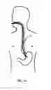 Fig. 16 - ENDO-NAVIGATION SYSTEMS AND METHODS FOR SURGICAL PROCEDURES AND CPR
