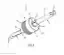Fig. 03 - Dental drill system