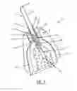 Fig. 04 - Dental drill system