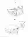 Fig. 04 - CLEAR ALIGNER AND MANUFACTURING METHOD THEREOF, TRACTION DEVICE FOR CLEAR ALIGNER, AND AID FOR TRACTION DEVICE FOR CLEAR ALIGNER