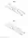 Fig. 05 - CLEAR ALIGNER AND MANUFACTURING METHOD THEREOF, TRACTION DEVICE FOR CLEAR ALIGNER, AND AID FOR TRACTION DEVICE FOR CLEAR ALIGNER