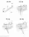 Fig. 07 - CLEAR ALIGNER AND MANUFACTURING METHOD THEREOF, TRACTION DEVICE FOR CLEAR ALIGNER, AND AID FOR TRACTION DEVICE FOR CLEAR ALIGNER