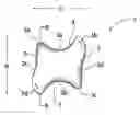 Fig. 01 - Therapeutically contoured, compliance encouraging aligner implement