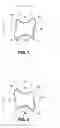 Fig. 02 - Therapeutically contoured, compliance encouraging aligner implement