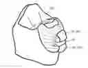 Fig. 01 - Orthodontic bracket and a method of making an orthodontic bracket