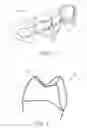 Fig. 02 - Orthodontic bracket and a method of making an orthodontic bracket