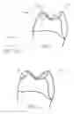 Fig. 03 - Orthodontic bracket and a method of making an orthodontic bracket