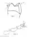 Fig. 04 - Orthodontic bracket and a method of making an orthodontic bracket