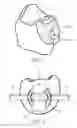 Fig. 05 - Orthodontic bracket and a method of making an orthodontic bracket