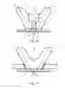 Fig. 05 - Orthodontic Brackets