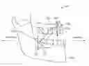 Fig. 01 - Mandibular advancement and retraction via bone anchoring devices