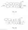 Fig. 02 - Mandibular advancement and retraction via bone anchoring devices