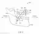 Fig. 03 - Mandibular advancement and retraction via bone anchoring devices
