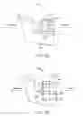 Fig. 06 - Mandibular advancement and retraction via bone anchoring devices