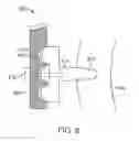 Fig. 09 - Mandibular advancement and retraction via bone anchoring devices