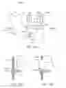 Fig. 16 - Mandibular advancement and retraction via bone anchoring devices