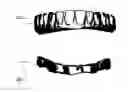 Fig. 01 - Dental implant prosthesis