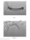 Fig. 04 - Dental implant prosthesis