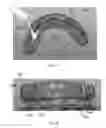 Fig. 07 - Dental implant prosthesis
