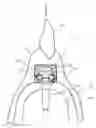Fig. 01 - ATTACHMENT FOR DENTURE