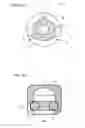 Fig. 04 - ATTACHMENT FOR DENTURE