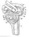 Fig. 01 - Ligament assembly