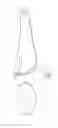 Fig. 02 - APPARATUS AND PROCESS FOR DELIVERING A SILICONE PROSTHESIS INTO A SURGICAL POCKET