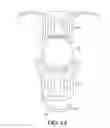 Fig. 04 - Semi-rigid framework for a plate haptic accommodating intraocular lens