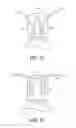 Fig. 09 - Semi-rigid framework for a plate haptic accommodating intraocular lens