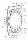 Fig. 01 - Intraocular lens assembly