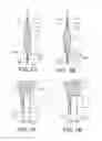 Fig. 04 - Intraocular lens assembly