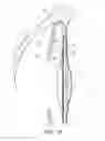 Fig. 08 - Intraocular lens assembly