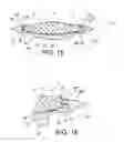 Fig. 11 - Intraocular lens assembly
