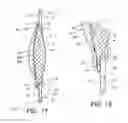 Fig. 12 - Intraocular lens assembly