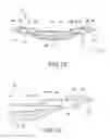 Fig. 15 - Intraocular lens assembly