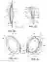 Fig. 19 - Intraocular lens assembly