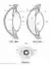 Fig. 23 - Intraocular lens assembly