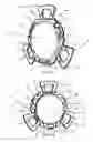 Fig. 25 - Intraocular lens assembly