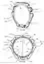 Fig. 26 - Intraocular lens assembly