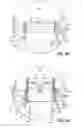 Fig. 12 - Apparatus and methods for implanting a replacement heart valve