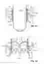 Fig. 15 - Apparatus and methods for implanting a replacement heart valve