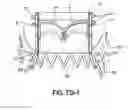 Fig. 16 - Apparatus and methods for implanting a replacement heart valve